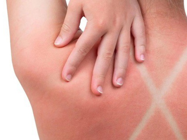 Điều tưởng bình thường này có thể kích hoạt “chuỗi phản ứng ung thư”