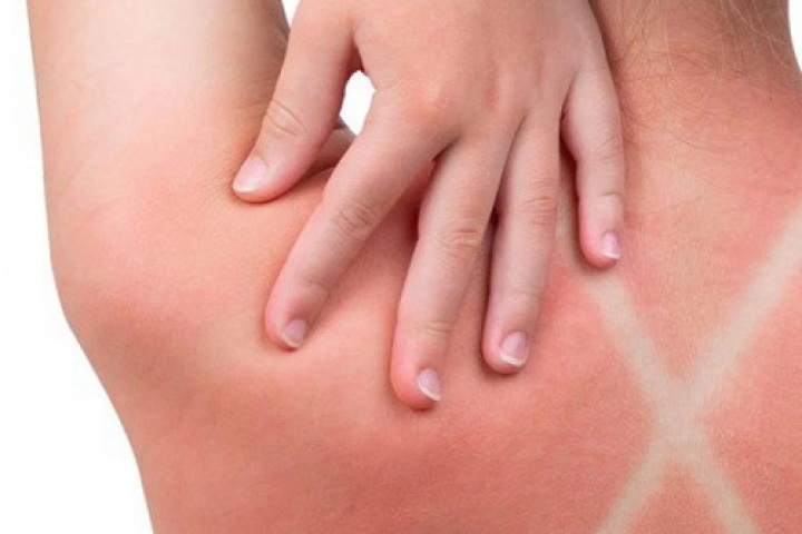 Điều tưởng bình thường này có thể kích hoạt “chuỗi phản ứng ung thư”