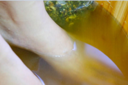 4 vị trí trên cơ thể nên chăm sóc kỹ vào mùa đông