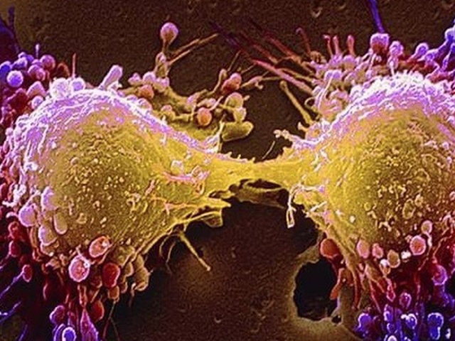 Món ăn thơm ngon khoái khẩu ngày lạnh nhưng tiềm ẩn tế bào ung thư, người Việt nên biết để tránh