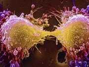 Món ăn thơm ngon khoái khẩu ngày lạnh nhưng tiềm ẩn tế bào ung thư, người Việt nên biết để tránh