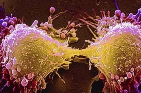 Món ăn thơm ngon khoái khẩu ngày lạnh nhưng tiềm ẩn tế bào ung thư,...