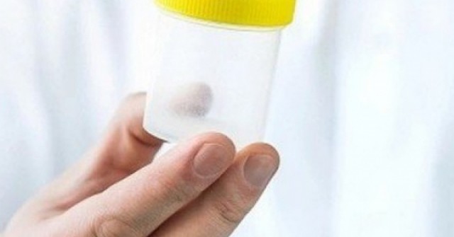 Tinh dịch đổi màu: Dấu hiệu bệnh lý không thể chủ quan