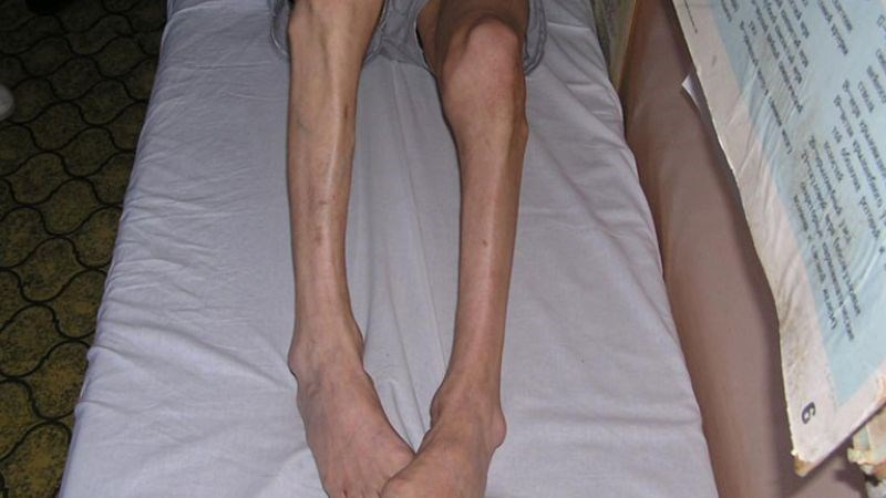 Người bị tê bì chân tay: Ăn thế nào để “thoát” cảnh mệt mỏi, đau nhức kéo dài? - 3