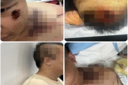 Ám ảnh trận đòn 'nhập môn' tại Trung tâm Công tác xã hội Hải Hà