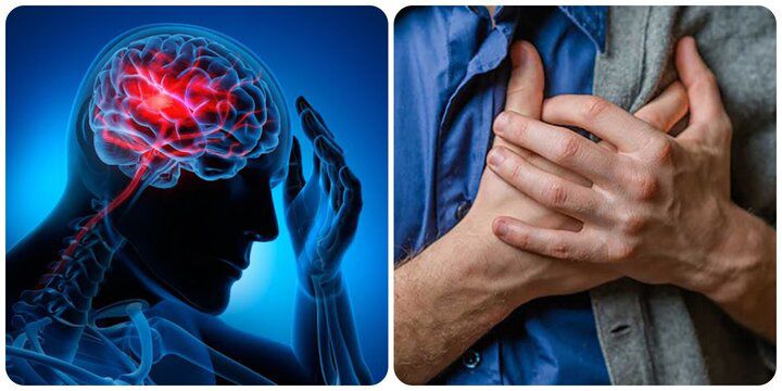 Đột quỵ ban đêm tăng mạnh, bác sĩ cảnh báo: Dù ở độ tuổi nào, trước khi ngủ cũng cần nhớ '5 không' - 2