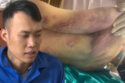 Vụ học viên tử vong ở Trung tâm CTXH Hải Hà: Gã bảo vệ khai gì khi hành hung nạn nhân?