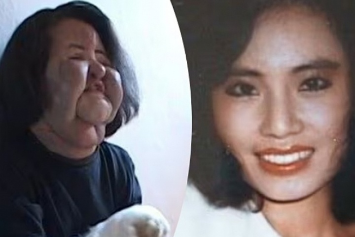 Đời bi kịch vì phẫu thuật thẩm mỹ của 'ca sĩ mặt quạt' Han Hye Kyung