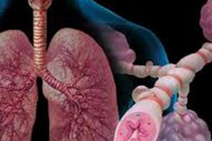 5 'nguyên tắc vàng' giúp người bệnh hen sống khỏe trong mùa lạnh