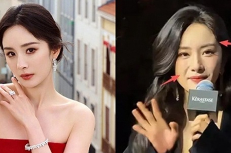 Diễn viên Dương Mịch tuổi 40 lộ gương mặt sưng phù khác lạ