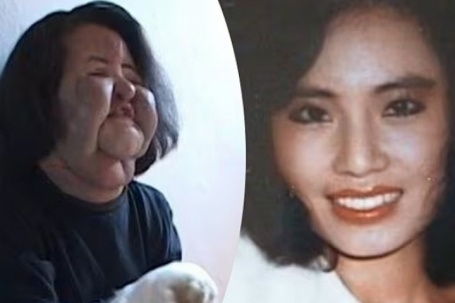 Đời bi kịch vì phẫu thuật thẩm mỹ của 'ca sĩ mặt quạt' Han Hye Kyung