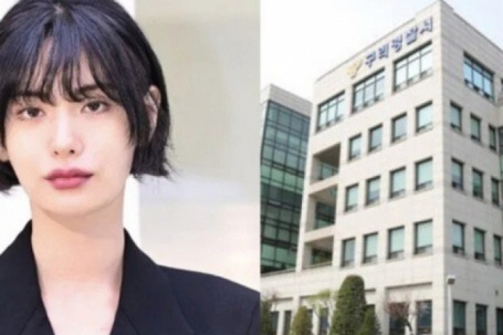 Tai họa không đáng có của  " mỹ nhân đẹp nhất thế giới " 