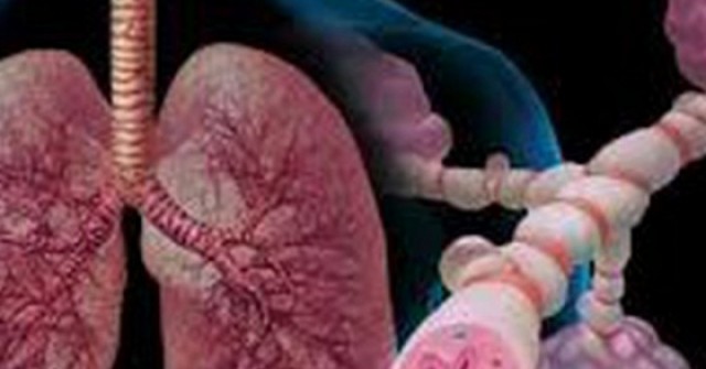 5 "nguyên tắc vàng" giúp người bệnh hen sống khỏe trong mùa lạnh