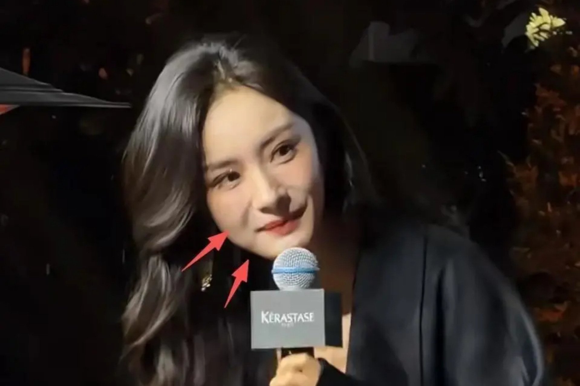 Gương mặt Dương Mịch được nhận xét đơ cứng do can thiệp thẩm mỹ.&nbsp;