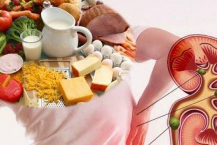 6 nguyên tắc trong ăn uống giúp người bệnh suy thận ngăn ngừa biến chứng