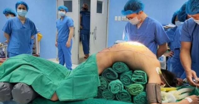 Ca mổ 10 tiếng hồi sinh cuộc đời nam thanh niên suốt 7 năm "cắm đầu xuống đất"