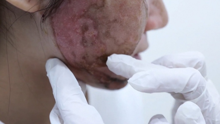 Dồn dập tai biến cao điểm làm đẹp ‘cấp tốc’ mùa Tết - 3