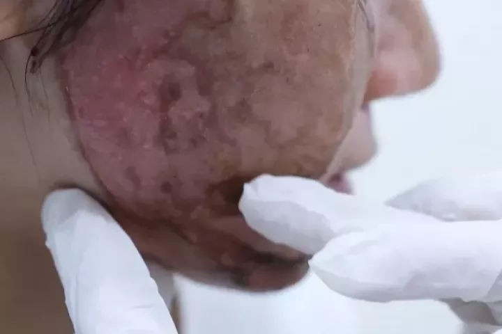 Dồn dập tai biến cao điểm làm đẹp ‘cấp tốc’ mùa Tết