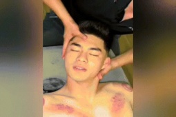 Khoảnh khắc thủ môn Trung Kiên đi giác hơi sau buổi tập hút triệu view