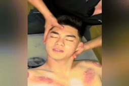 Khoảnh khắc thủ môn Trung Kiên đi giác hơi sau buổi tập hút triệu view