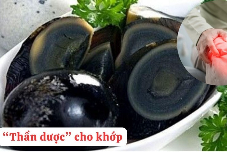 “Tái sinh” khớp gối với món ăn đại bổ giúp xương khớp cử động trơn tru