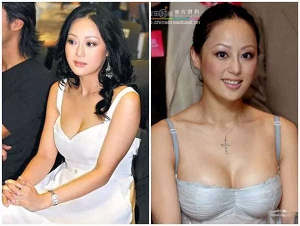 Chương Tiểu Huệ khi còn trẻ. HK01.