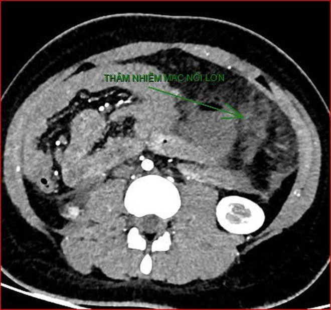 Bệnh viện Việt Nam - Cu Ba Đồng Hới phát thông cáo về ca bệnh hiếm gặp gây tử vong - 2