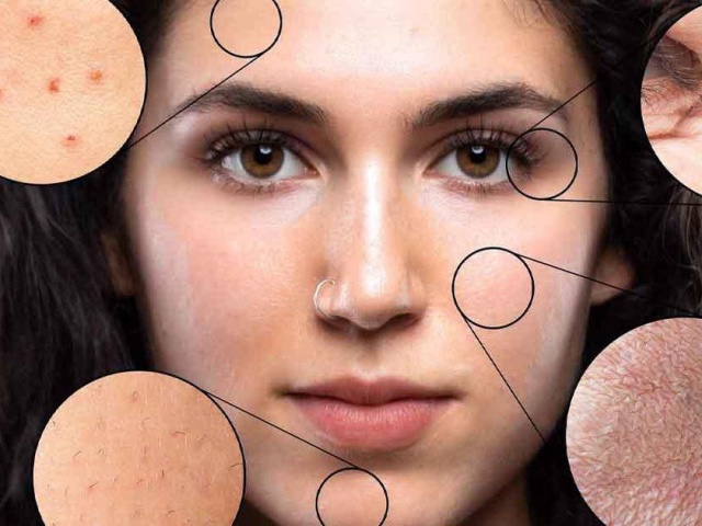 70% ca ung thư hắc tố bắt nguồn từ những thói quen tưởng như vô hại nhiều người mắc phải