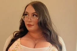 Cô gái khổ sở vì bộ ngực nặng 25 kg