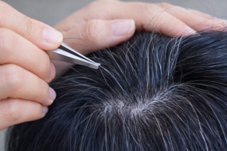 Một thói quen phổ biến ai bị tóc bạc cũng làm khiến tóc càng bạc, càng thưa