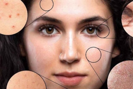 70% ca ung thư hắc tố bắt nguồn từ những thói quen tưởng như vô hại nhiều người mắc phải