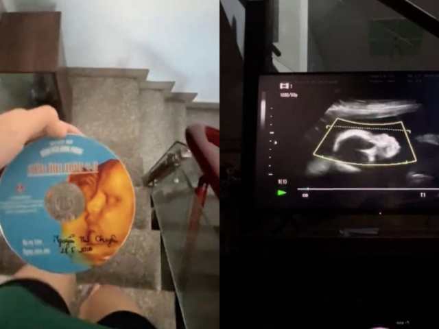Clip siêu âm thai vừa tìm thấy và tâm thư người con làm dân mạng 'cay sống mũi'