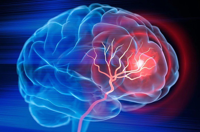 Các nhà khoa học Mỹ đang phát triển một phương pháp đột phá nhằm giúp bệnh nhân đột quỵ phục hồi hiệu quả hơn - Ảnh minh họa: SCITECH DAILY