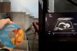 Clip siêu âm thai vừa tìm thấy và tâm thư người con làm dân mạng  ' cay sống mũi ' 
