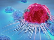 Thói quen âm thầm 'nuôi lớn' tế bào ung thư, nhiều người Việt đang mắc phải