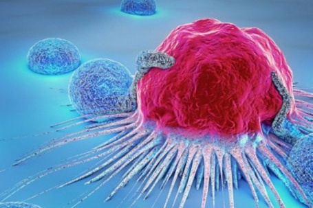 Thói quen âm thầm 'nuôi lớn' tế bào ung thư, nhiều người Việt đang mắc...