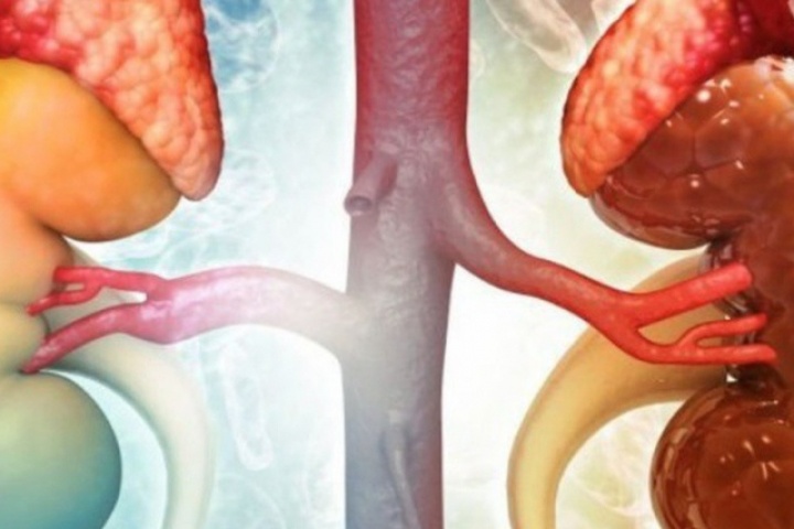 Loại quả giàu dinh dưỡng nhiều người Việt thích ăn nhưng người bệnh suy thận cần phải tránh