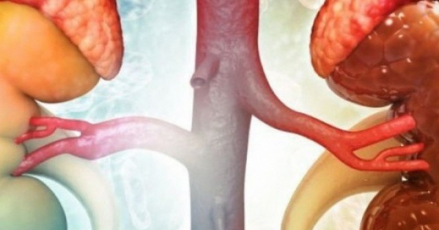 Loại quả giàu dinh dưỡng nhiều người Việt thích ăn nhưng người bệnh suy thận cần phải tránh