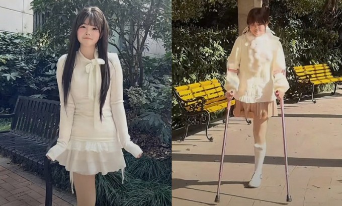 Mất một chân, Thế Vĩ luôn lạc quan và tự lập trong cuộc sống. Ảnh: Douyin