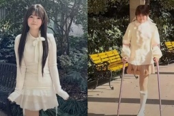 Cô gái ung thư xương bị gia đình bỏ rơi, tự ký giấy phẫu thuật