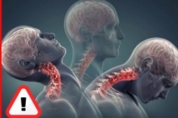 Tin tức sức khỏe - Đau lưng, mỏi vai gáy, tê bì chân tay “đeo bám” - Tố cáo bạn “phạm” sai lầm này!