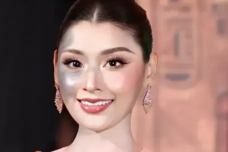 Người đẹp bị chàm nửa gương mặt giành giải á hậu