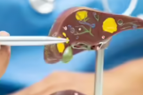 Những thói quen đang gây tổn thương gan mỗi ngày