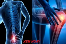 Tin tức sức khỏe - Đau lưng, mỏi vai gáy tái phát dữ dội mùa lạnh là dấu hiệu bệnh gì? Chuyên gia vạch trần thủ phạm gây sốc!