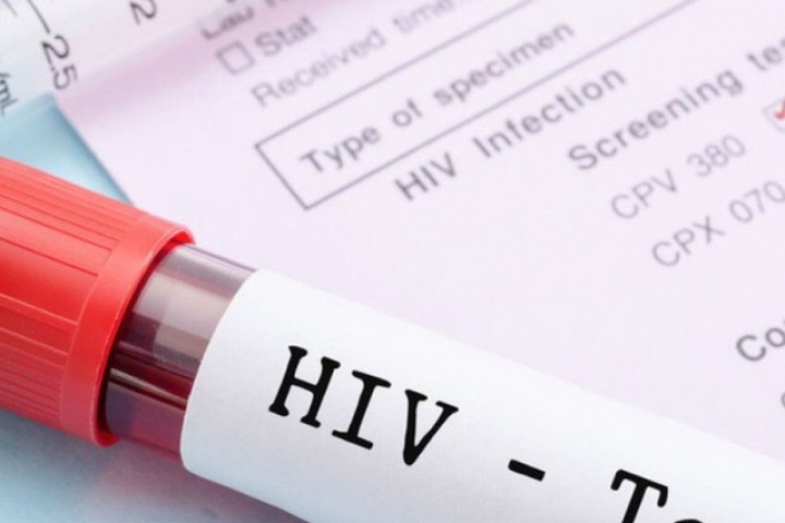 Đi khám vì đau họng dai dẳng, mảng trắng lan nhanh trong miệng, cô gái bất ngờ phát hiện HIV