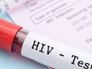 Đi khám vì đau họng dai dẳng, mảng trắng lan nhanh trong miệng, cô gái bất ngờ phát hiện HIV