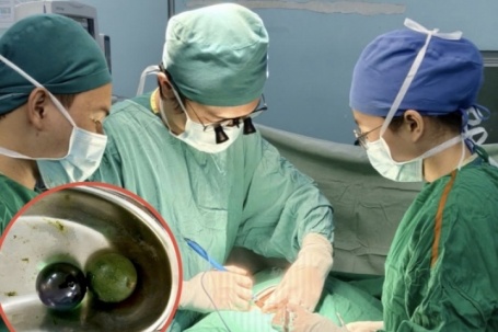 Bé gái 18 tháng tuổi nguy kịch, ruột tắc nghẽn vì nuốt hạt nở đồ chơi