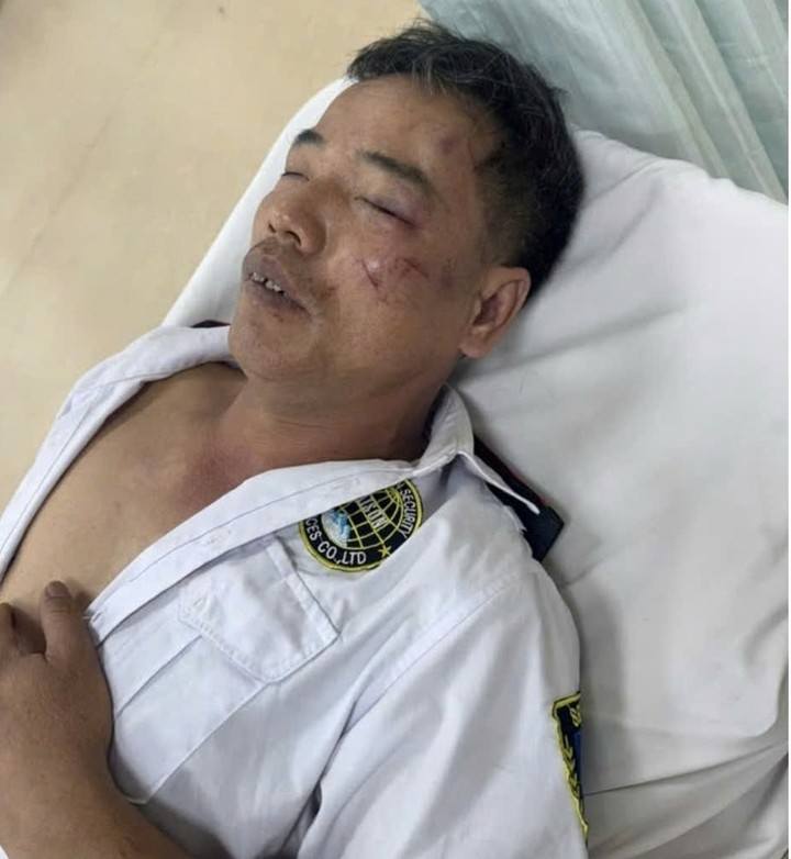 Nạn nhân bị gãy xương sườn và đa chấn thương. (Ảnh: B.L)