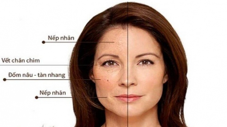 Gương mặt, làn da ở phụ nữ sau tuổi 40 sẽ có sự thay đổi rõ rệt.