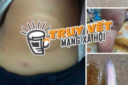 Thực hư thông tin bé 3 tuổi bị sâu biển cắn nguy kịch, gia đình tha thiết kêu gọi hỗ trợ máu hiếm